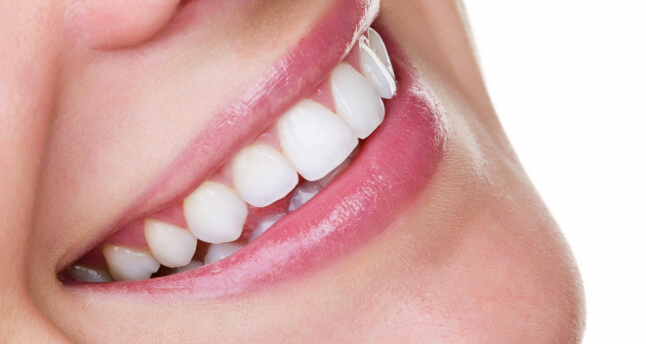 Why get Dental Implants?